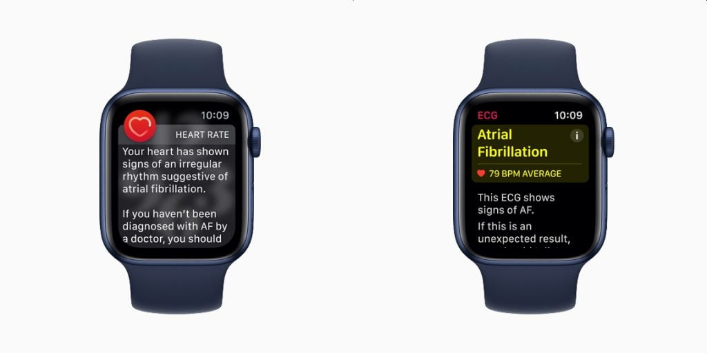 The Apple Watch Might Soon Be Facing An International Import Ban